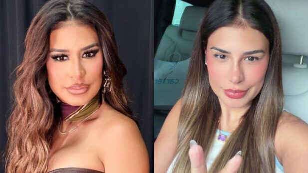 Comparativo de antes e depois mostra Simone Mendes em julho e após o procedimento em setembro de 2026
